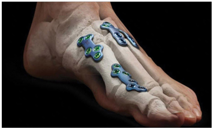 Lower extremity diagram 1