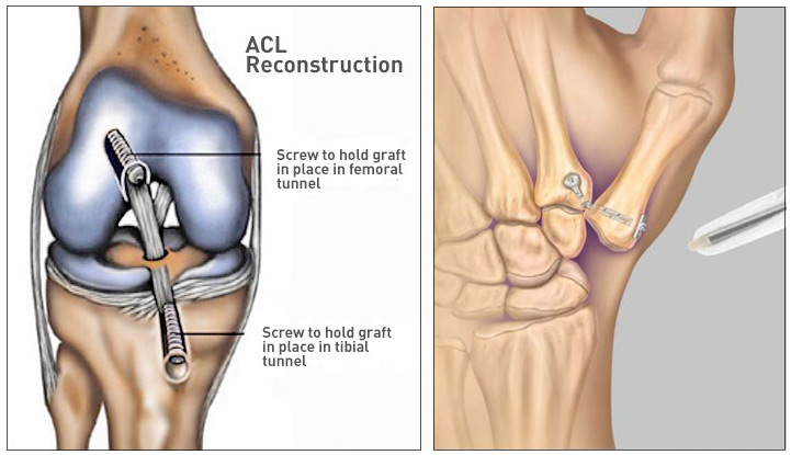 Sports medicine diagram 1