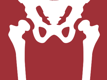 Total Hip Replacement