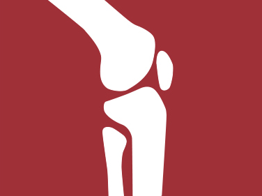 Total Knee Replacement